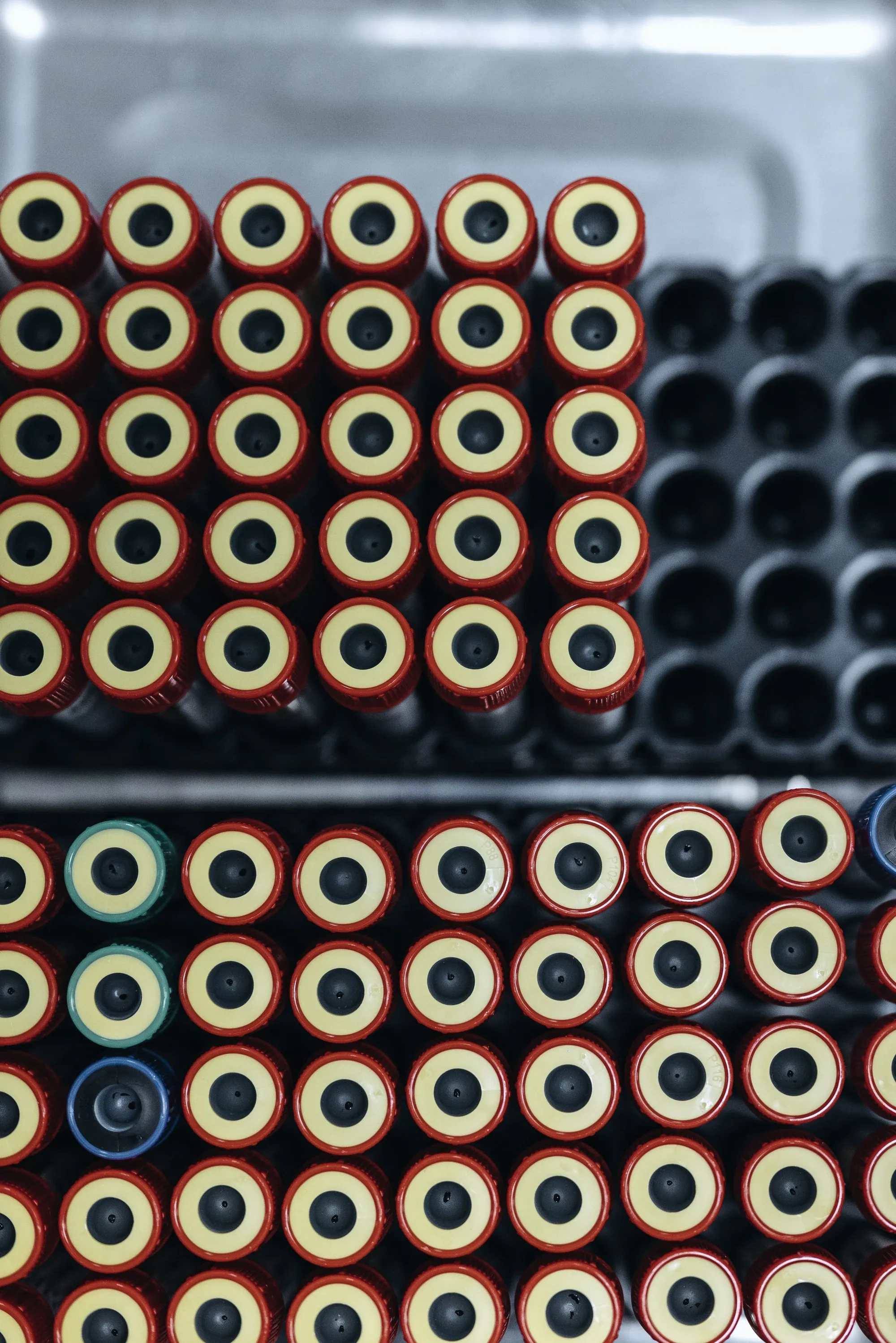Blood sample tubes packed upright in a laboratory rack