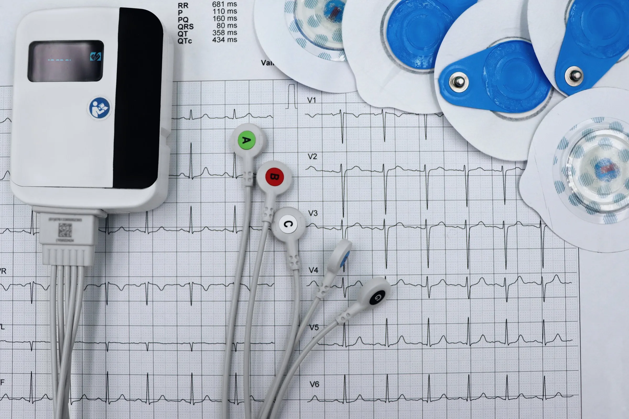 An electrocardiograph unit with leads and electrodes on a printed ECG trace